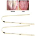 thumbnail image 2 of 2pcs Tongue Scraper Stainless Steel U Shape Tongue Cleaner for Oral Care Hygiene (Gold), 2 of 5