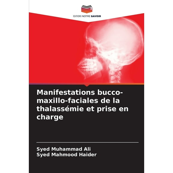 Manifestations bucco-maxillo-faciales de la thalassÃ©mie et prise en charge, (Paperback)