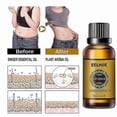 thumbnail image 2 of Pure Natural Ginger Oil for Lymphatic Drainage and Anti-Cellulite Massage, 100% Organic Tummy Slimming Solution, 2 of 5