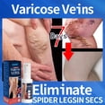 thumbnail image 5 of Ungüento efectivo para aliviar las venas varicosas, crema para aliviar la Vasculitis, flebitis, tratamiento del dolor de araña, 5 of 5