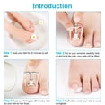 thumbnail image 1 of 2 piezas de levantador de uñas encarnadas, herramienta para uñas encarnadas, abrazadera para dedos, herramienta de acero inoxidable para el cuidado de los pies para paroniquia, plateado, 1 of 7