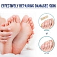thumbnail image 3 of 32pcs Corn Removal Pads, Corn Removers for Feet, Foot Corn Removers, Toes Corn Removal, 3 of 5