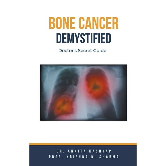 Bone Cancer Demystified: Doctor's Secret Guide, (Paperback)