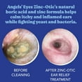 ANGELS’ EYES ZincOtic Ear Relief Treatment for Dogs and Cats Soothe