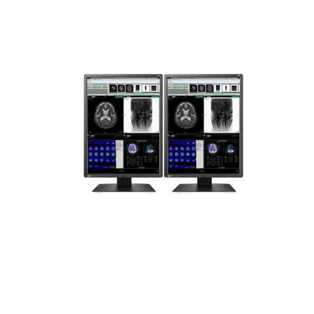 Pair (x2) New Eizo RadiForce RX350 3MP Color Medical Diagnostic Radiology Monitors