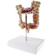 thumbnail image 3 of 1: 2 Modelo ógico de Grueso Herramienta de ñanza de Escuela Sunnimix Estatua de disco de intestino grueso, 3 of 8