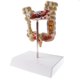 thumbnail image 3 of 1: 2 Modelo ógico de Grueso Herramienta de ñanza de Escuela Sunnimix Estatua de disco de intestino grueso, 3 of 8
