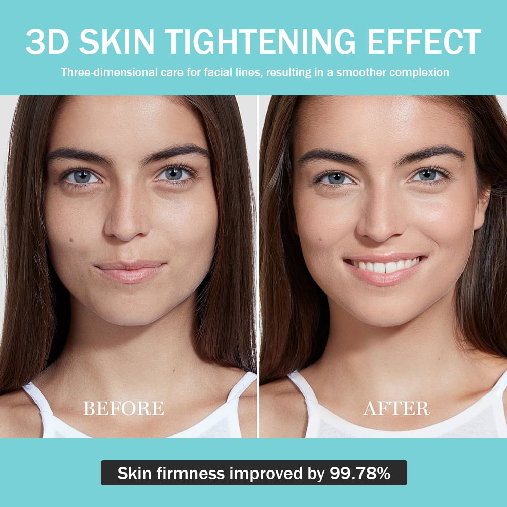 4-in-1 Facial Blue Light Therapy Skincare Wand Home Use Beauty Equipment for Enhanced Absorption, Pore Refinement