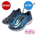thumbnail image 4 of Desinfectante para zapatos Pedifix ShoeZap con luz germicida UV 15 min, 4 of 8