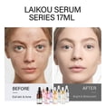 thumbnail image 3 of FeiKong Sueros faciales Sakura para reducir los poros, controlar la grasa, hidratar, blanquear y antienvejecimiento, 3 of 5