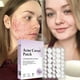thumbnail image 4 of Pimple Patches For Face, Pimple Patches, 3 SIZE,Round Covers, Hyaluronic Sour Complexion Cute Zit Covers (72 Count) Buy 2 Save 10%, 4 of 4