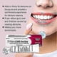 thumbnail image 5 of Long-lasting Denture-adhesive Lasting Super Hold Denture-adhesive Cream For Partial-dentures New Arrival, 5 of 5