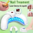 thumbnail image 2 of Nail Fungus Laser Treatment Device Fingernail Fungus Treat Onychomycosis Effectively Remove Onychomy, 2 of 5