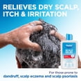 thumbnail image 3 of Flexitol Scalp Relief Shampoo & Conditioner, Gentle Cleansing System for Dry, Itchy Scalp, Colloidal Oatmeal Formula, 8 oz Bottles, 3 of 12