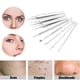 thumbnail image 4 of Blackhead Removers Comedone Pimple Removal Extractors Acne Blemish Needles Tool Kit Tratamiento para Whitehead Popping Zit Nose Face Skincare, 8 en 1 con estuche de metal Vhermosa LRWJ600, 4 of 4