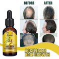 thumbnail image 3 of Leke 1pc Solución acondicionadora capilar de jengibre Solución nutritiva para el cabello, hidratante, reafirmante y anticaída 40 ml | 7332565040515, 3 of 4