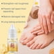 thumbnail image 2 of Bee Venom Fungal Nail Treatment For Toenail Extra Strong, Nail Fungus Solution, Anti Toe Toenail Nail Fungal Solution For Ingrown Toenail Treatment, 2 of 5