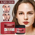 thumbnail image 2 of Crema blanqueadora de pecas Crema para pecas Crema blanqueadora hidratante para eliminar manchas oscuras, 2 of 9