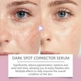thumbnail image 3 of Freckle Repair Cream, 3 of 6