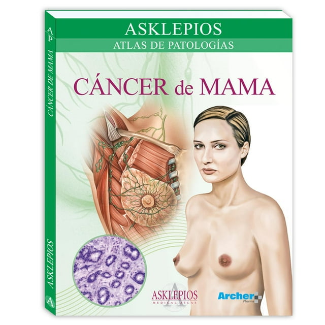 Atlas del cáncer de mama