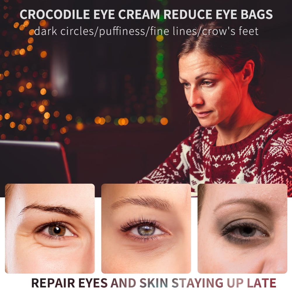 eye bags and dark circles cream at walmartTikTok Search