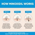 thumbnail image 3 of Tratamiento para el crecimiento del cabello, espuma Vocks con 5% de minoxidil para hombres, 3 of 6