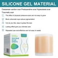 thumbnail image 4 of Silicone Scar Stickers Medical Silicone Easy-tear Gel Tape Roll Medical Grade, 4 of 5