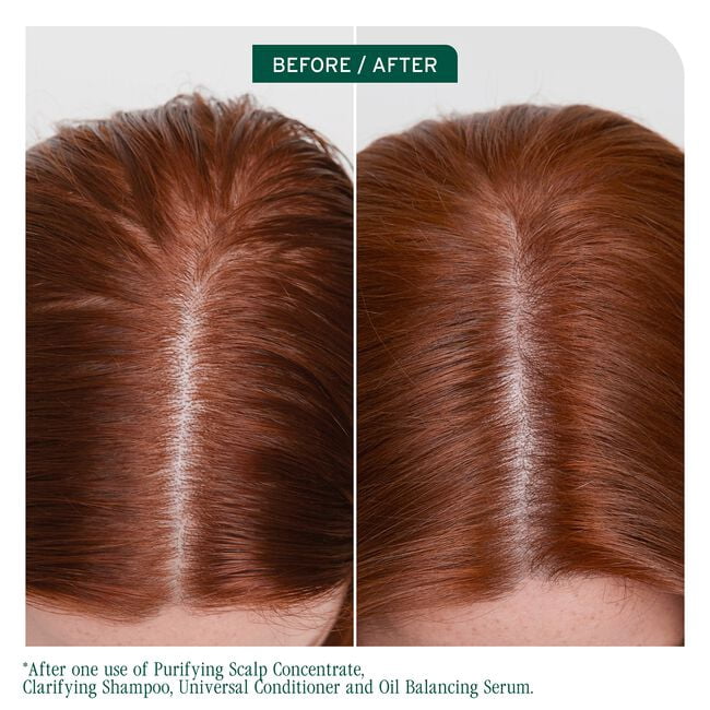 Biolage Scalp Sync Clarifying Shampoo 33.8 fl.oz