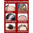 thumbnail image 4 of Productos para el crecimiento del cabello, biotina, Spray anticaída, tratamiento del cuero cabelludo, cuidado AHair de rápido crecimiento, aceites esenciales para hombres y mujeres, cuidado AHair, 4 of 5