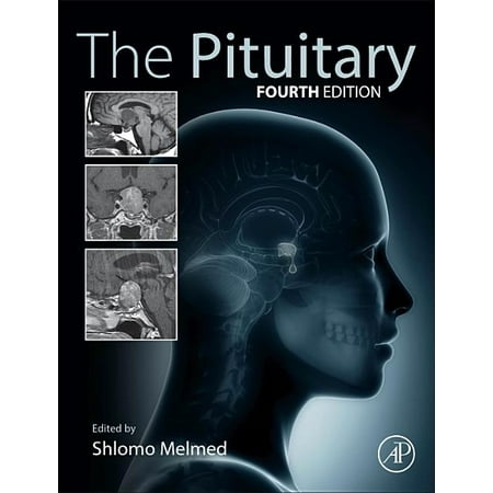 UPC: 9780128041697 | The Pituitary