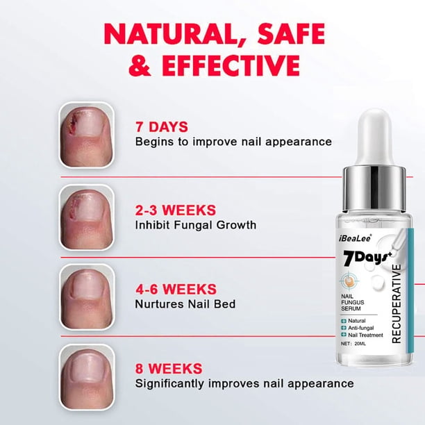 Líquido reparador de uñas de 20 ml Líquido eficaz para tratamiento de uñas Multiusos para el cuidado de los pies