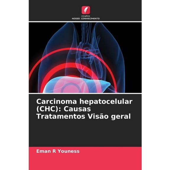 Carcinoma hepatocelular (CHC): Causas Tratamentos Visão geral, (Paperback)