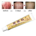 thumbnail image 3 of Psoriasis Cream Relieve Skin itching for Dermatitis and Eczema Pruritus Psoriasis Ointment Creams New, 3 of 5