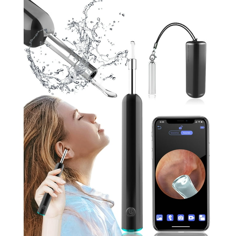 ear wax cameras