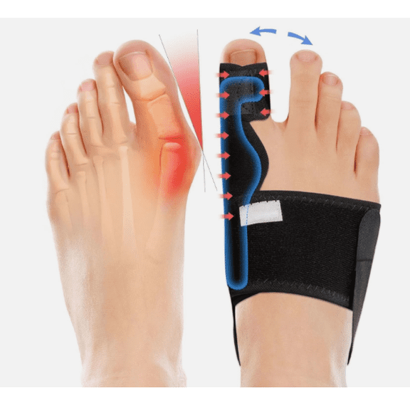 Bunion Corrector for Women & Men, Big Toe Straightener Bunion Splint for Pain Relief & Alignment