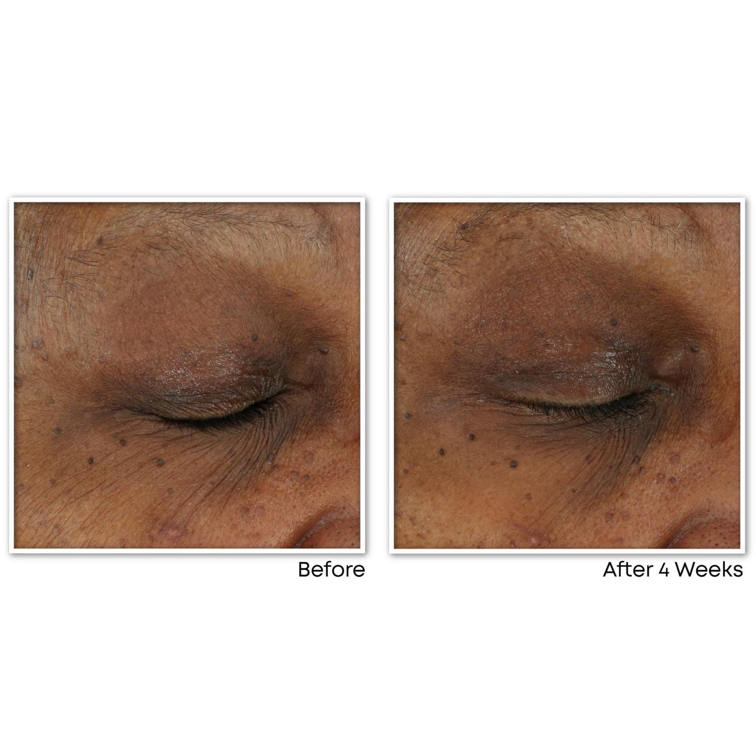 RoC Skincare - Multi Correxion Revive + Glow Daily Serum - 30mL