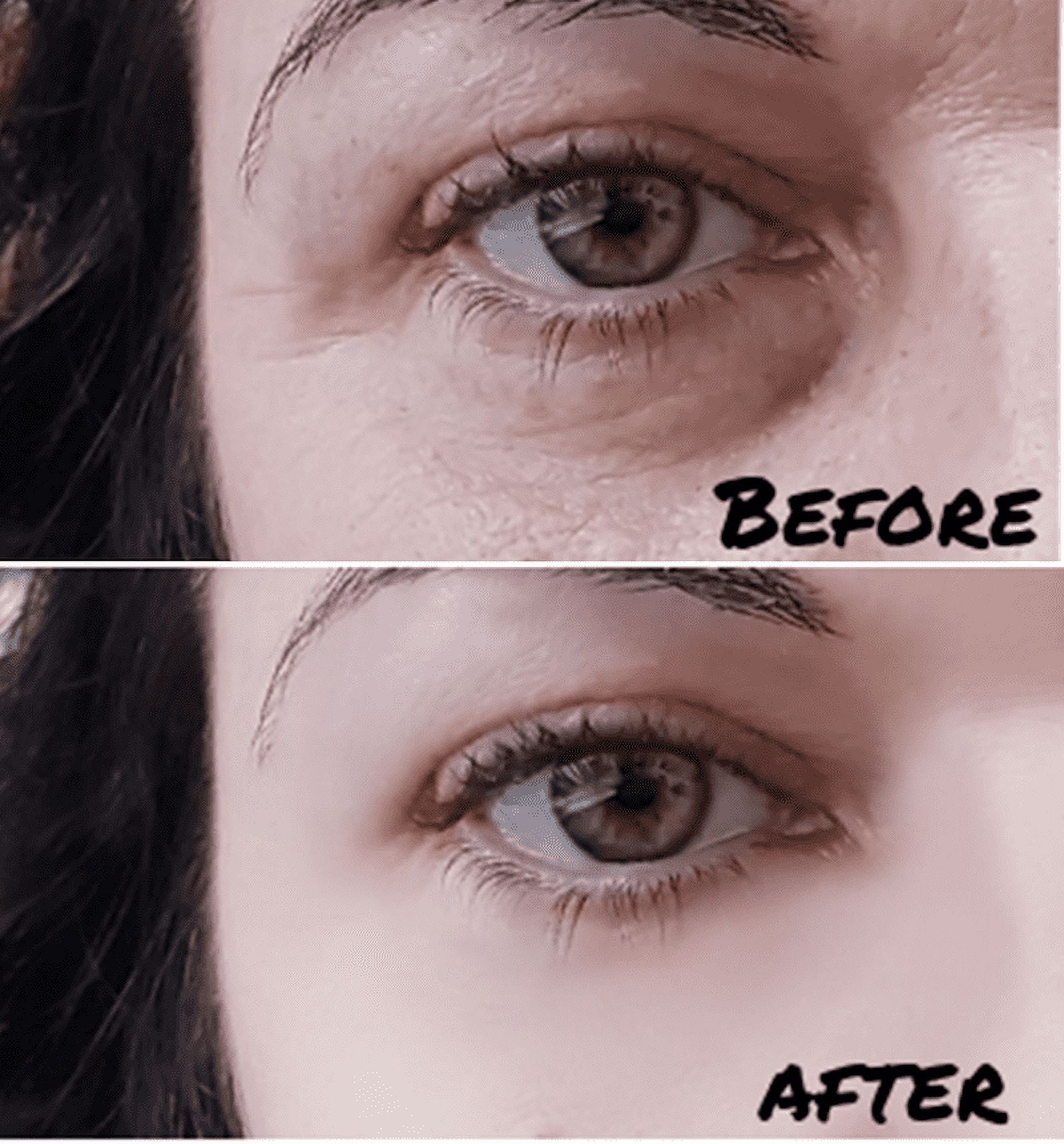 Eyetitude Prozerve Peptide Eye Cream