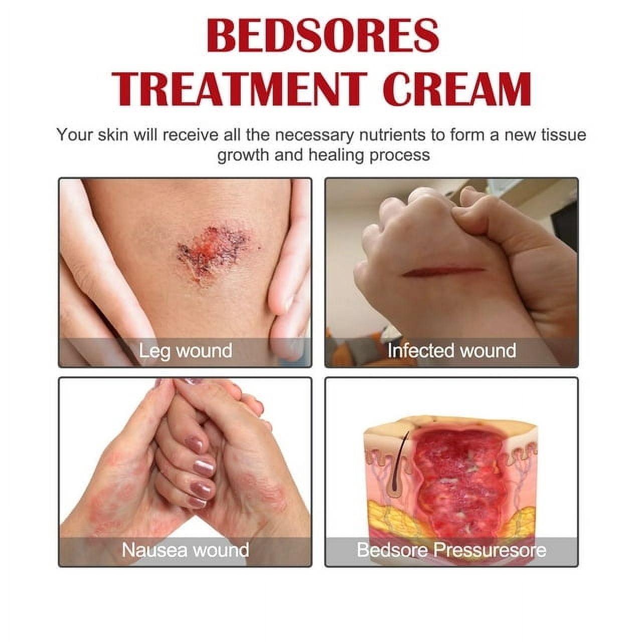 Decubitus Cream Pressure Sore Ulcer Skin Relief Ointment Bed Sore Wound Healing Treat Anti Dry Repair Moisturizing Body Care 20g