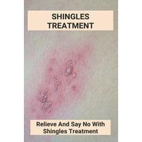 Shingles Treatment: Relieve And Say No With Shingles Treatment: Shingles On Face Treatment, (Paperback)