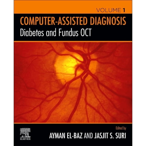 Computer-Assisted Diagnosis Diabetes and Fundus Oct, (Paperback)