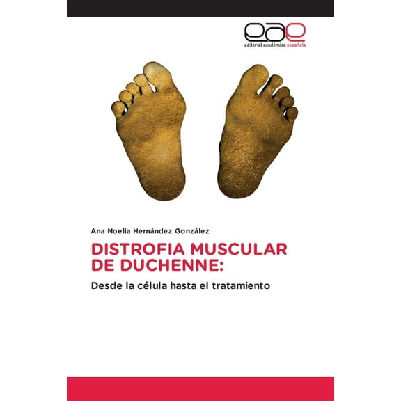 Distrofia Muscular de Duchenne, (Paperback)