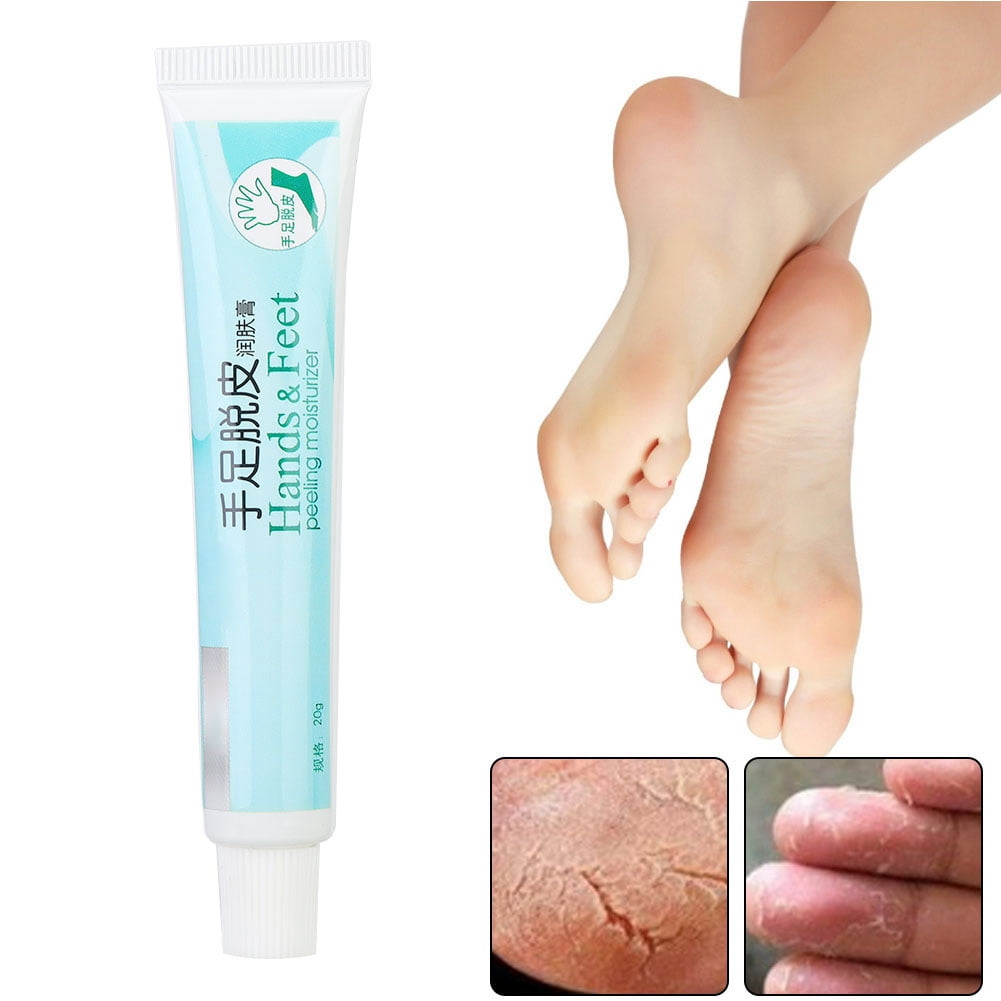 OTVIAP Moisturizing Cream, Chapped Foot Repair Cream,Dry Rough Skin