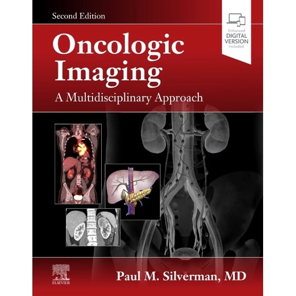 Oncologic Imaging: A Multidisciplinary Approach, (Hardcover)