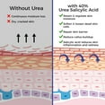 thumbnail image 5 of OUKEYA Urea Cream 42% + Salicylic Acid 2% Repair Moisturizer for Dry Hands, Heels, Elbows , 5.29 oz, 5 of 7
