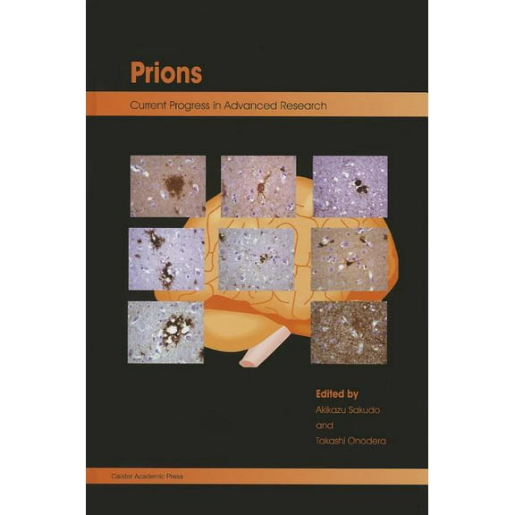 Prions: Current Progress in Advanced Research