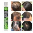 thumbnail image 2 of Herramienta para el cabello denso con esencia natural espesante para la prevención de la caída del cabello (simple) Ehuebsd cuidado belleza, 2 of 6