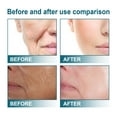 thumbnail image 3 of Vitamin C Face Serum – Hydrating & Nourishing Formula for Fine Line Reduction, Skin Firming, Brightening & Smoothing – Gentle Moisturizer for a Radiant, Youthful Glow, 3 of 5