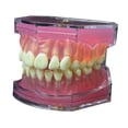 thumbnail image 1 of Modelo de enseñanza oral,Modelo de extracción dental Modelo de enseñanza oral,Kit educativo para la práctica de extracción de dientes,Instrumento dental modelo didáctico, 1 of 9