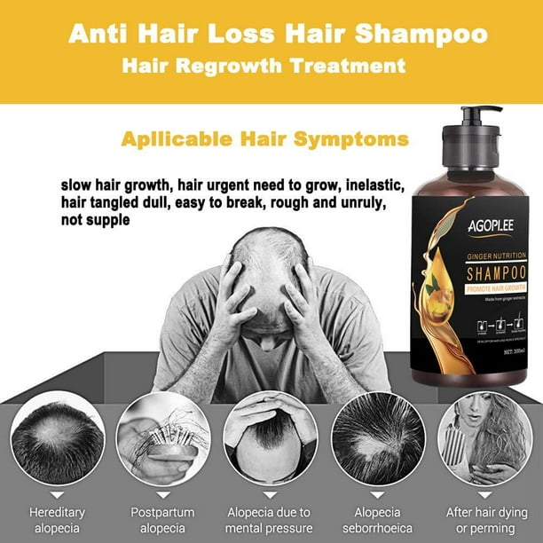 Hair Growth Shampoo for Men & Anti-Hair Loss Shampoo, Hair Loss shampoo, Natural Old Ginger Hair Care Shampoo, Helps Stop Hair Loss, Grow Hair Loss Treatment (10OZ) - Walmart.com