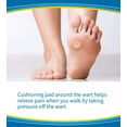 Dr. Scholl’s Clear Away Plantar Wart Removal Foot Treatment, 24